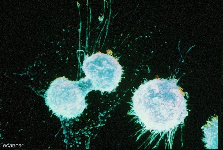 Ovarian cancer cells dividing. Credit: ecancer